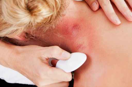 TCM Gua Sha