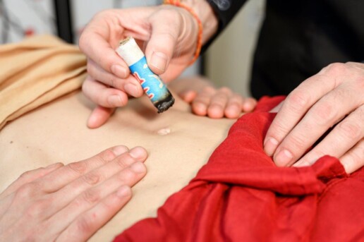 TCM Moxa Moxibustion Wärmebehandlung
